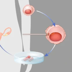 Kıbrıs Embriyo Donasyonu