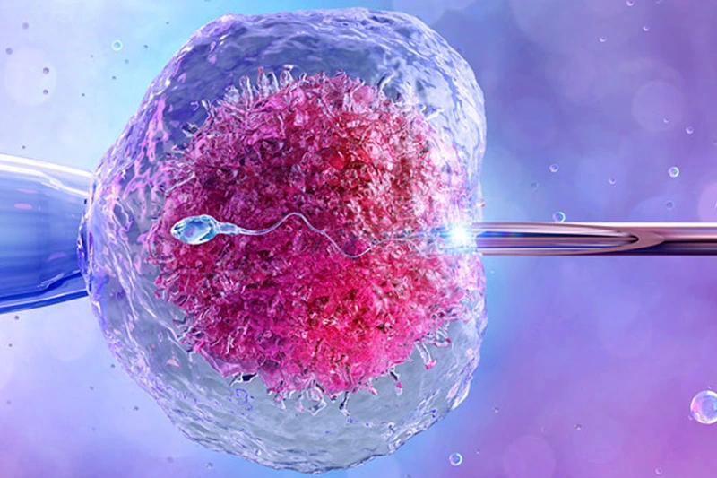 Kıbrıs'ta Tüp Bebek Tedavisi