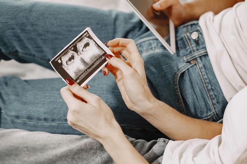 tüp bebek tedavisinde yumurta donasyonu