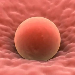 Kıbrıs Yumurta Donasyonu