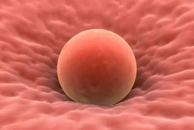 Kıbrıs Yumurta Donasyonu