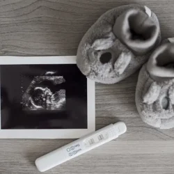 Kıbrıs Tüp Bebek Tedavisi Başarısını Arttıran 7 Neden